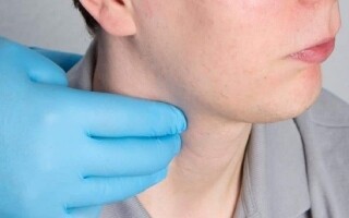 New Study Questions Need for Surgery in Carotid Stenosis